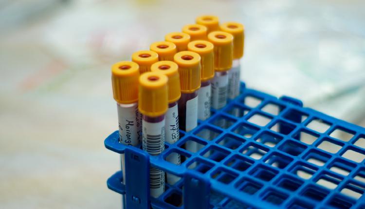 /images/nobel-prize-regulatory-t-cells.jpg